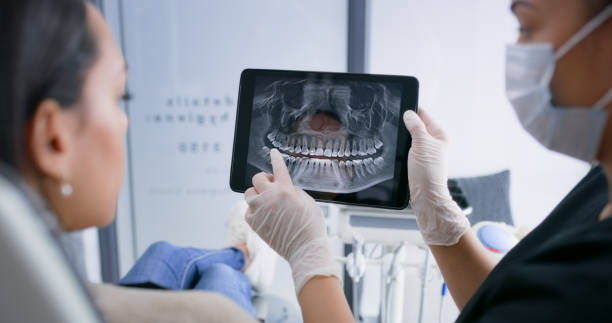 Licensed Tooth Extraction service in San Gabriel, CA - Smile Center Dentistry